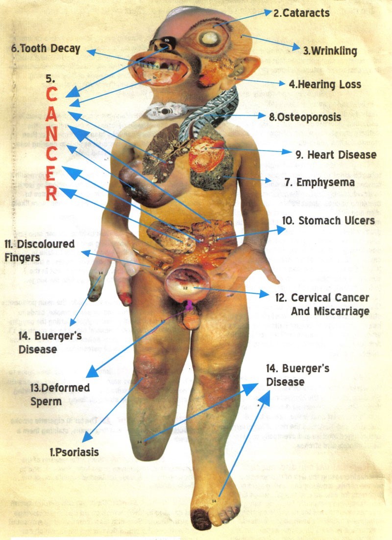 A smoker’s body showing the effects of smoking. / Illustration: Pan African Health Organization.