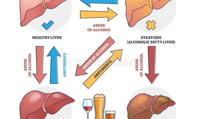 Hepatitis Can’t-Wait: Here is What You Should Know